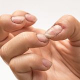 Effective Awareness About Dirty Nails
