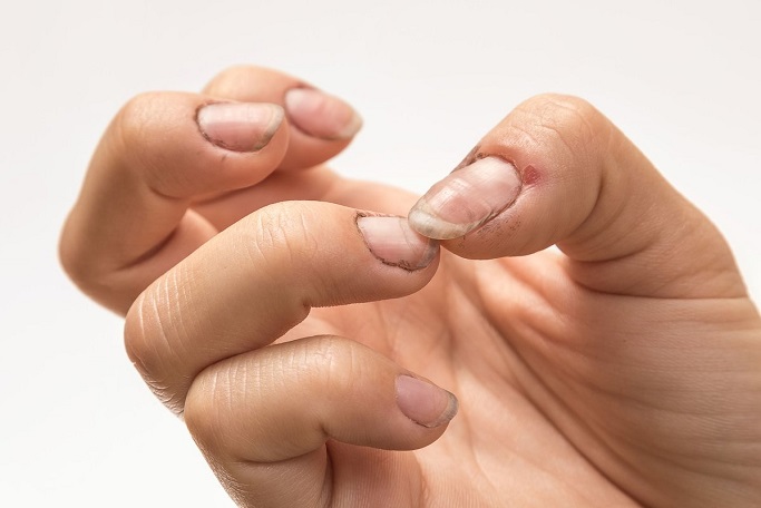 Effective Awareness About Dirty Nails – Makeup by Ruth Effective Awareness About Dirty Nails – Makeup by Ruth